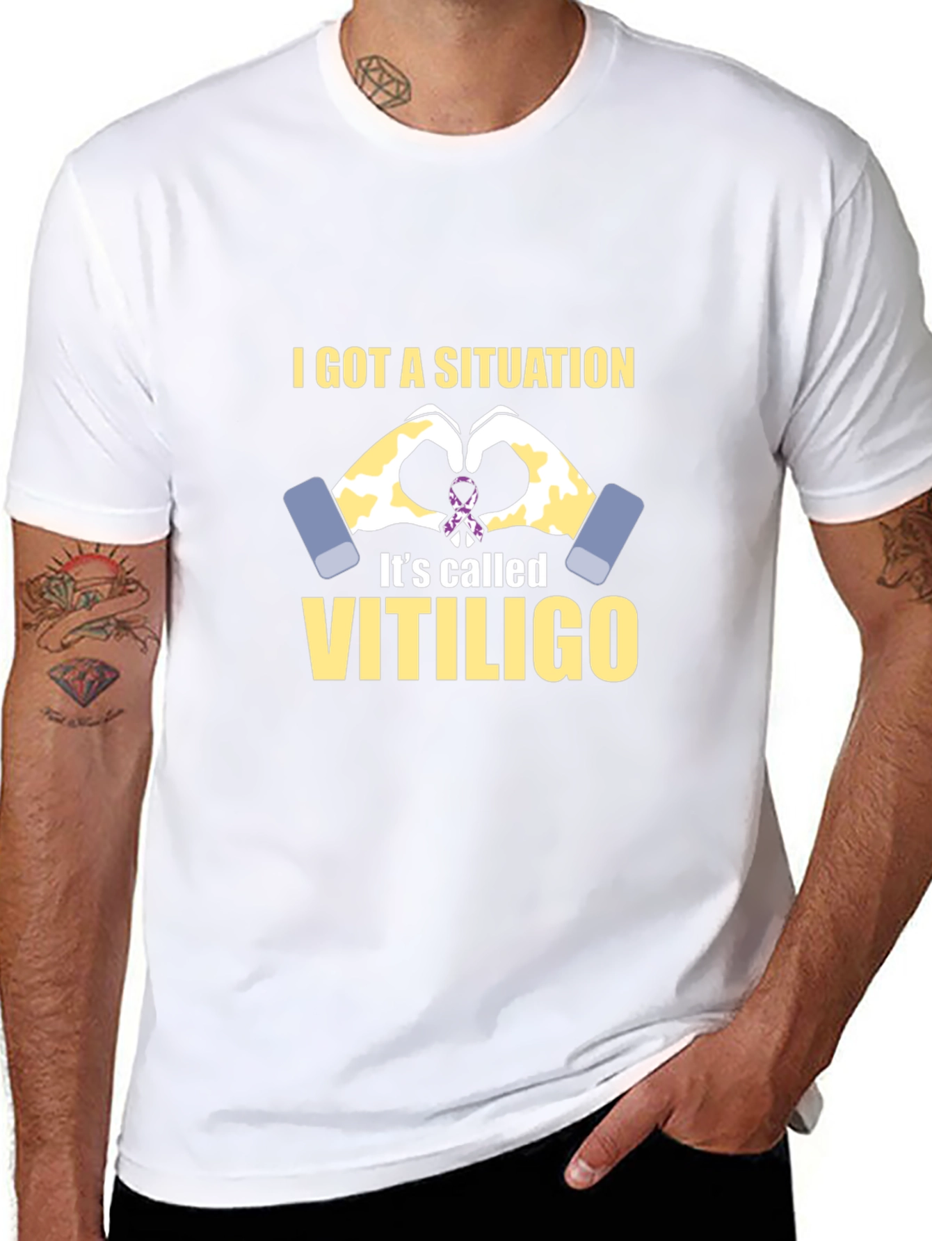 Vitiligo Awareness T-Shirt